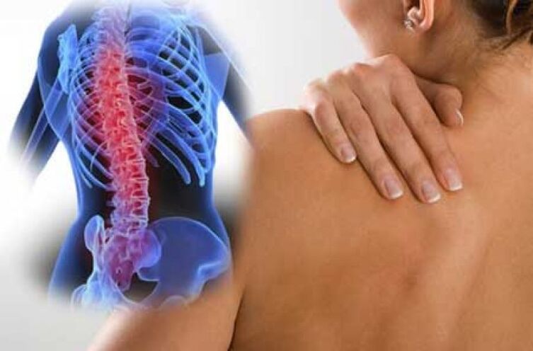 أثناء تفاقم تنخر العظم في العمود الفقري الصدري ، يحدث ألم الظهر