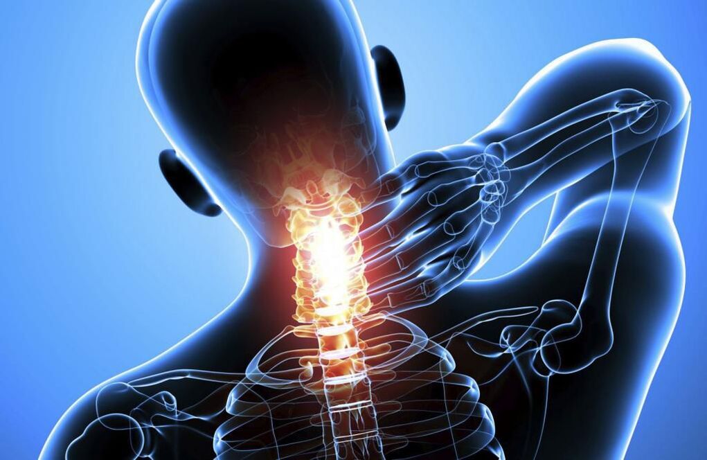 الداء العظمي الغضروفي في العمود الفقري العنقي